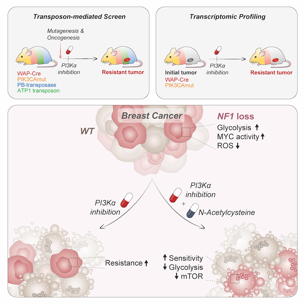 N-acetylcysteine Helps Combat Resistance in Breast Cancer