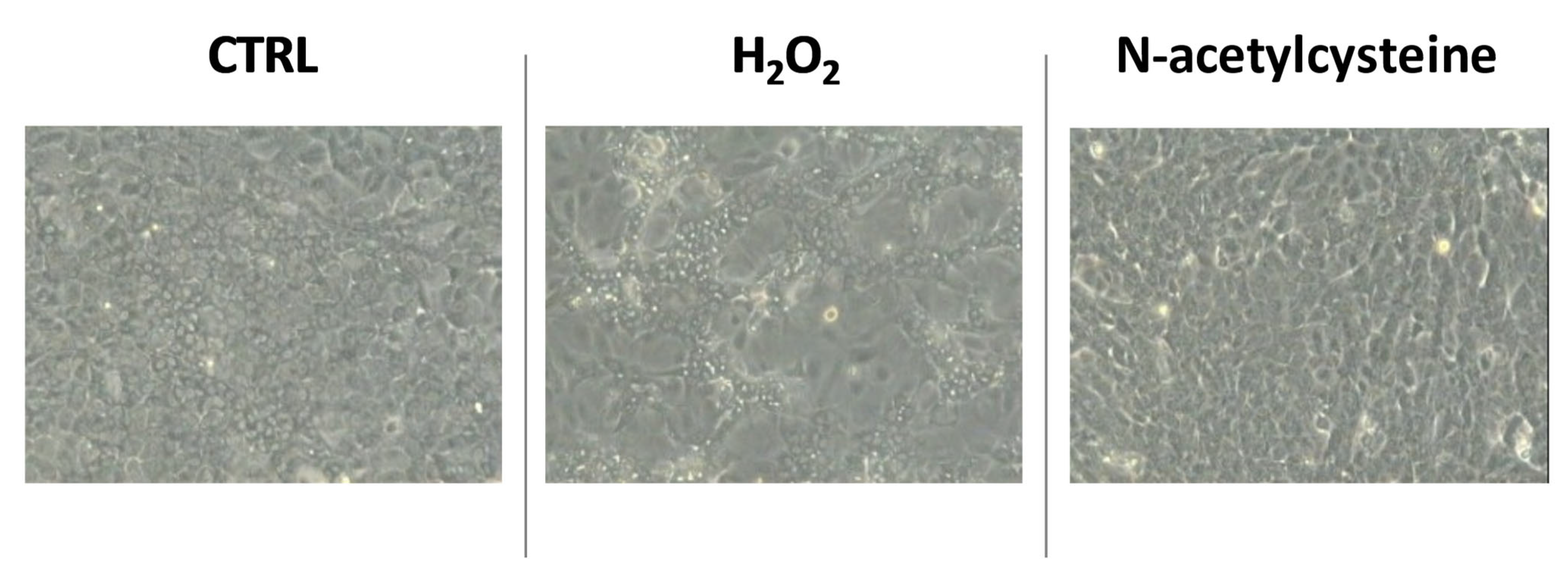 Redox-Dependent Modulation of Human Liver Progenitor Cell Line Fate 2