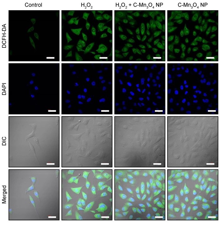 Redox Nanomedicine Towards Ameliorating Chronic Kidney Disease 2