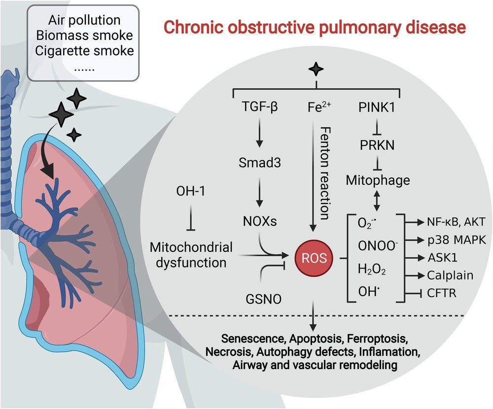 Redox signaling at the crossroads of human health and disease