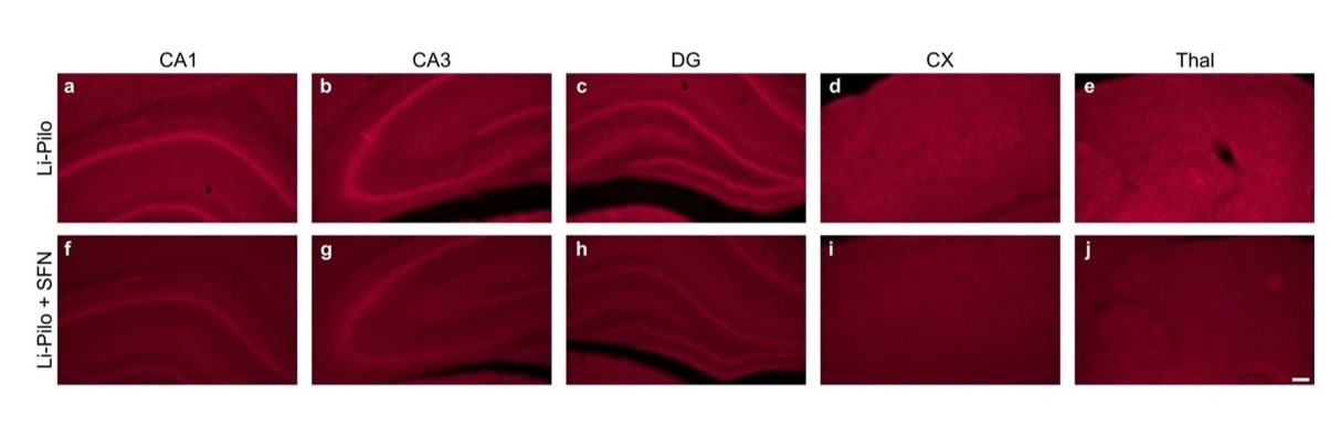 Sulforaphane Protects Against Oxidative Stress  Mitochondrial Dysfunction Associated with Status Epilepticus 2