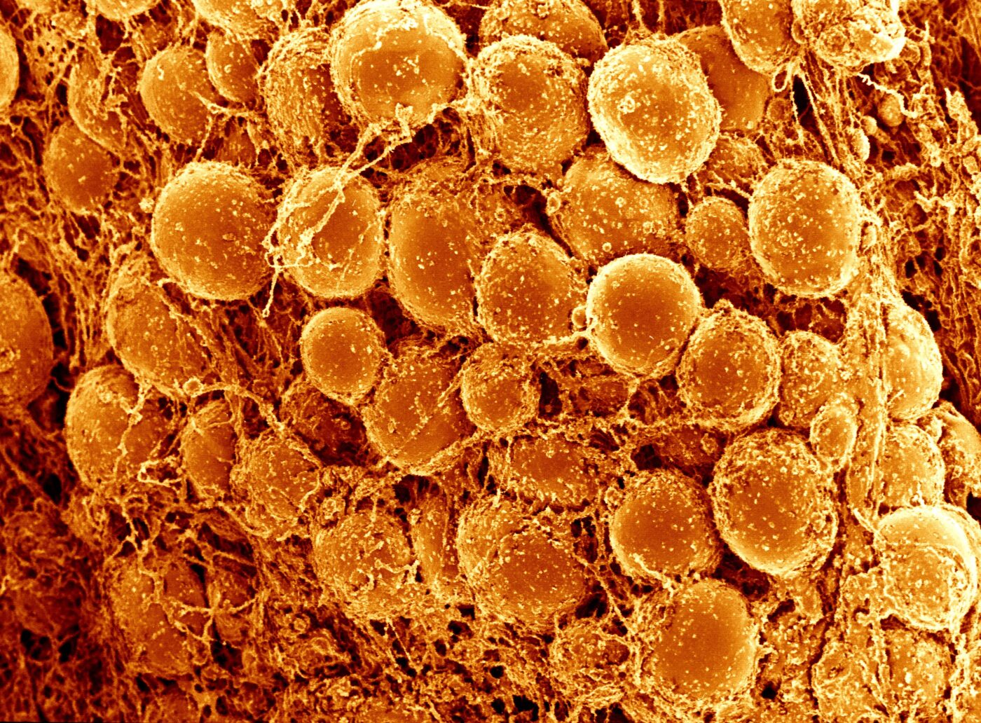 picture of brown adipose tissue