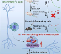 How Sensory Neuron Disturbances Shape Transient Pain into Chronic Pain