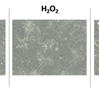 Redox-Dependent Modulation of Human Liver Progenitor Cell Line Fate