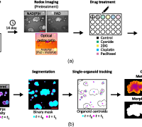 Redox Imaging: A Promising Method for Monitoring Cancer Treatment Response 