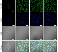Redox Nanomedicine: Towards Ameliorating Chronic Kidney Disease