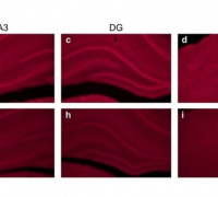 Sulforaphane Protects Against Oxidative Stress & Mitochondrial Dysfunction Associated with Status Epilepticus